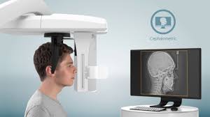 CT Cone Beam Technology CT Cone Beam Technology